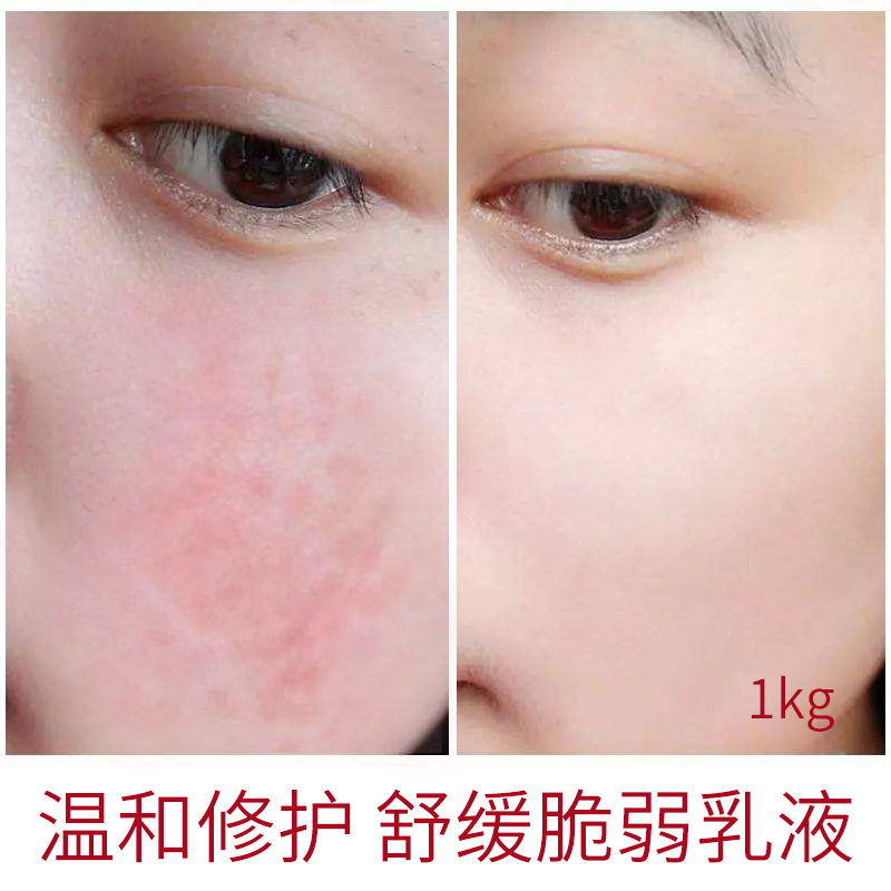 Gentian Soothing and Soothing Lotion Beauty Salon Sensitive Skin Moisturizing Lotion Hydrating and Moisturizing Hospital Line Specially for Skin Care Products Wholesale