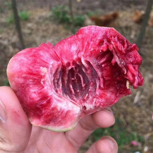 ���AѪ���Ҙ���r�� �t���Ҙ�Ʒ�N Ѫ���Ҙ��� �ڸ�����