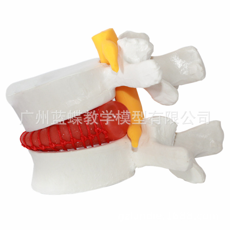 ׵����ģ����Ʒҽѧ������׵ͻ��������׵�ǲ�����ʾ�ؽڱ�׼ģ��