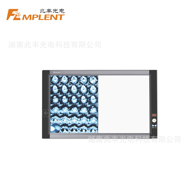 兆丰观片灯调光感应型LED薄款液晶双联阅片灯智能感应调光