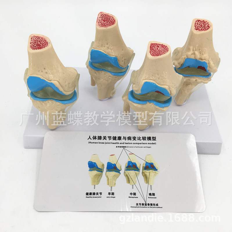 ϥ�ؽ�-����ģ�� �ؽڹ���-��̬չʾ����ϥ�ؽ�-����ģ�ʹ�˵����