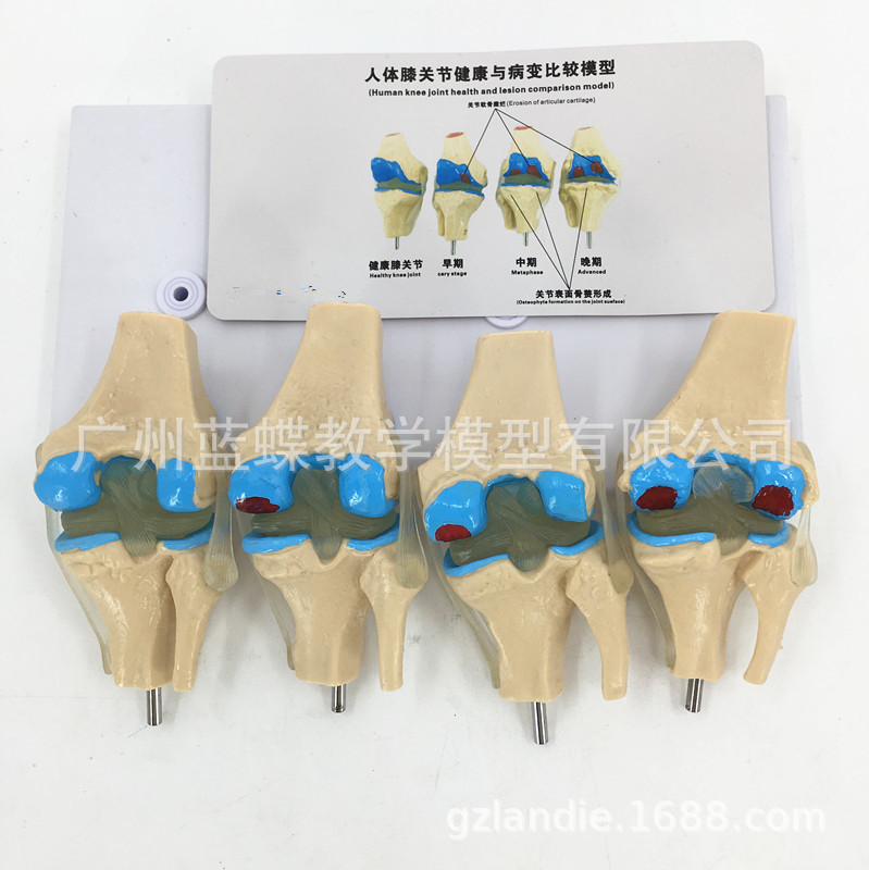 ϥ�ؽ�-����ģ�� �ؽڹ���-��̬չʾ����ϥ�ؽ�-����ģ�ʹ�˵����