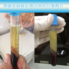 Three Forces Blood Collection Tube Medical PRP Beauty Tube Micro-dermal Serum Separation 8ml Aseptic Platelet Plasma Separation