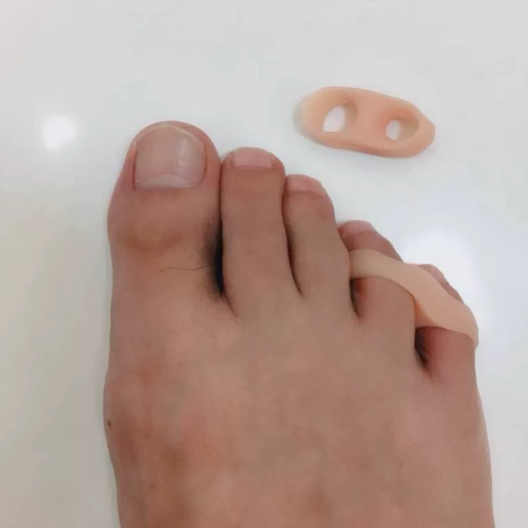 Малый вывернутый палец с перекрывающимся пальцем