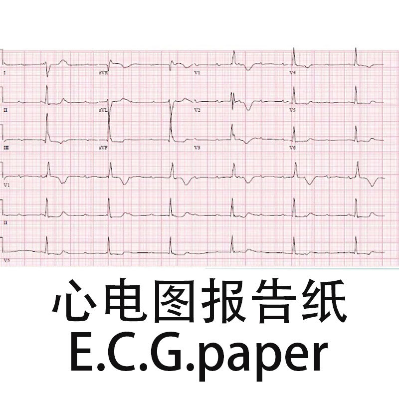 心电图纸-3