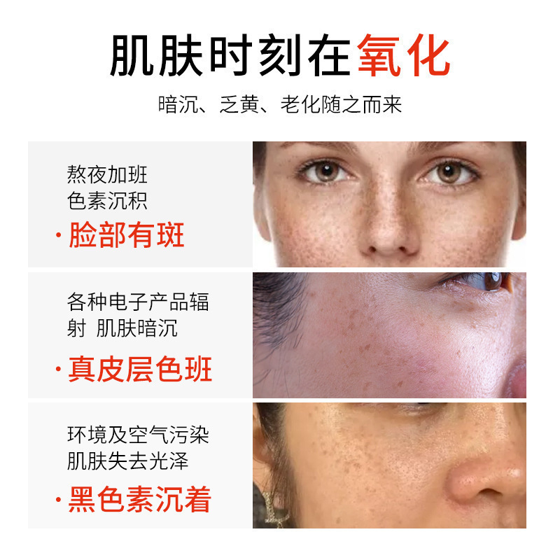 无尴尬期祛斑液去斑液全套排色液免提取不结痂美容院分解色素液|undefined