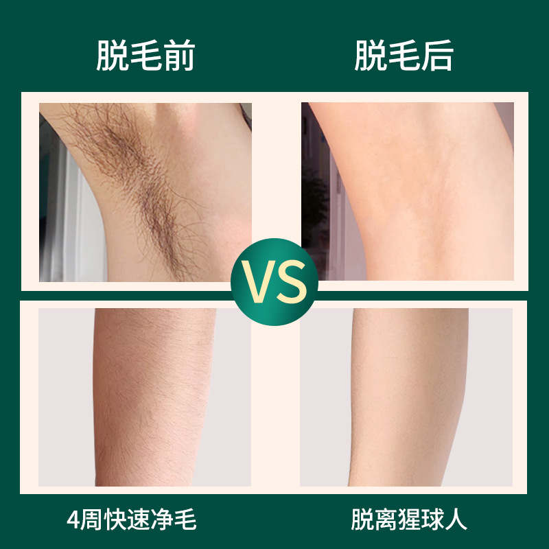 跨境亚马逊新款脱毛仪光子嫩肤美容仪家用红蓝光美容剃毛器全身