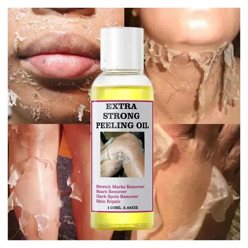 wiltshire-aching-yellow-peeling-173-brighten-lighten-dark-skin-fur-sing-arm-legs-melanin-frequency-removal-exexpeating