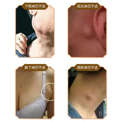 Lymph node dissolving health cream 30g, wholesale lymph swelling and pain dissolving ointment