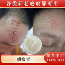 疤痕膏淡化剖腹产烧伤烫伤痘印痘坑抑制疤痕增生美容院修护身体乳