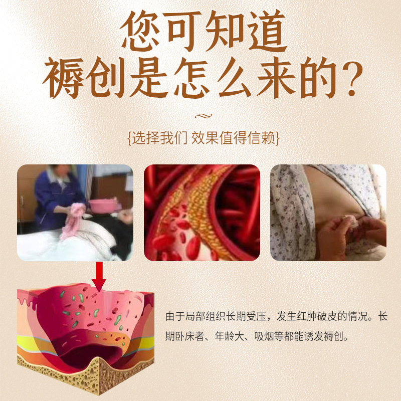 褥瘡保健クリームメーカー直髪寝たきり圧瘡皮膚クリーム皮膚褥瘡クリーム傷口癒合クリーム卸売り|undefined