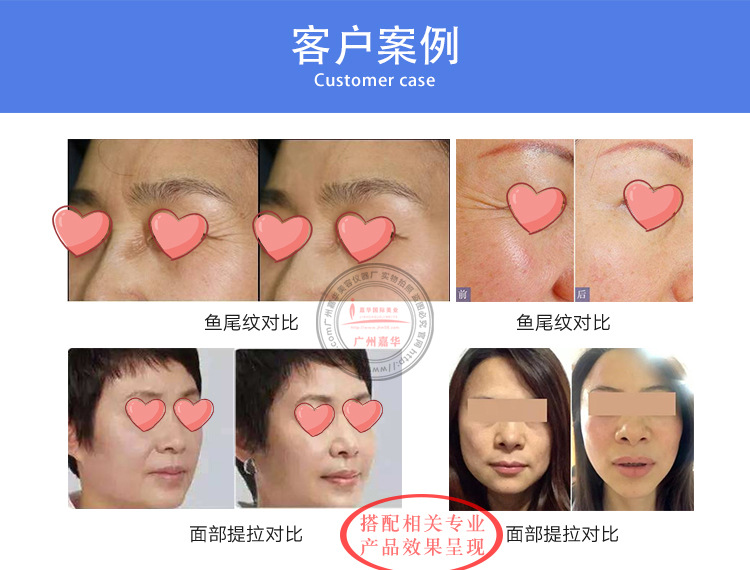 台式热拉提_09