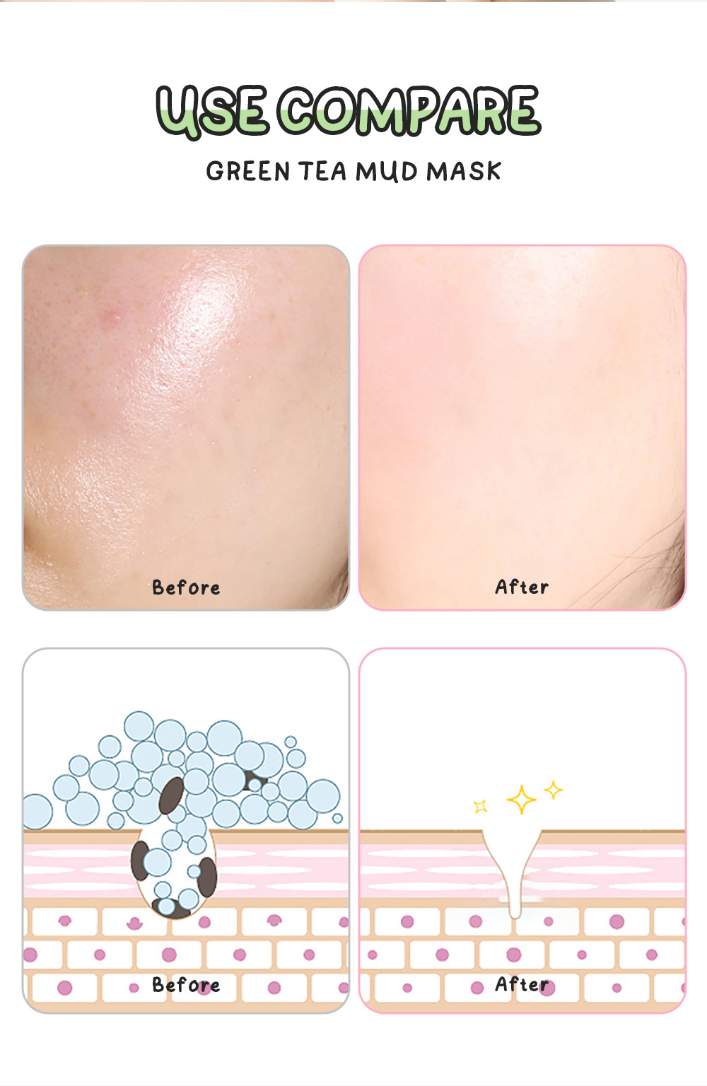 Cross-border fenyi Green Tea Mud Mask 100g(Indonesian Version) Cleansing, Hydrating and Moisturizing Skin Care Product Manufacturer in stock undefined