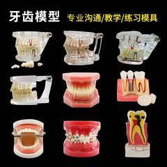 歯科の歯の模型の教育器材は歯の模型を植えます。