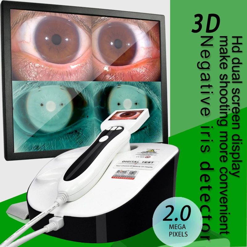 Hd детектор Радужки, тестер Радужки, увеличительное стекло, суб-здоровье