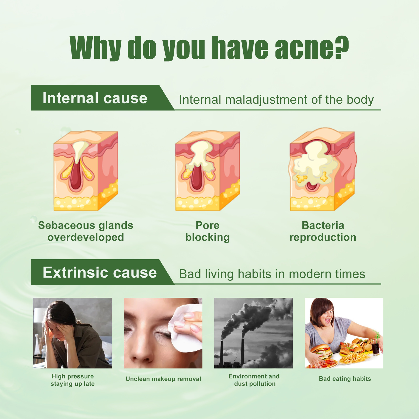 South Moon Acne Removing Gel to lighten acne scars, remove pimples, close mouth, clean brighten the skin, and_voghion.com