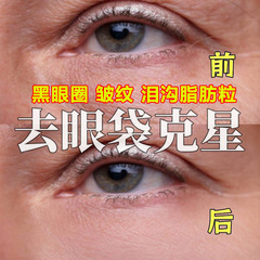 アイクリームは目の袋に行ってしわを取り除きます。