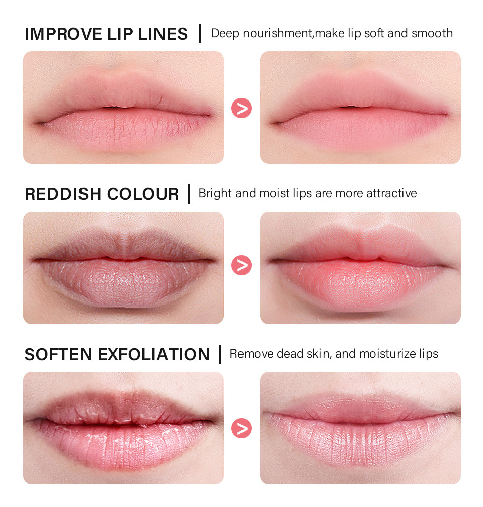 lakerain Sleep Lip Mask Item Picture