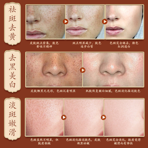 Whitening and Spot Removal Cream for Fair Skin, Enhances Complexion, Hydrating and Moisturizing, Fades Spots and Freckles, Whitening Cream for Women