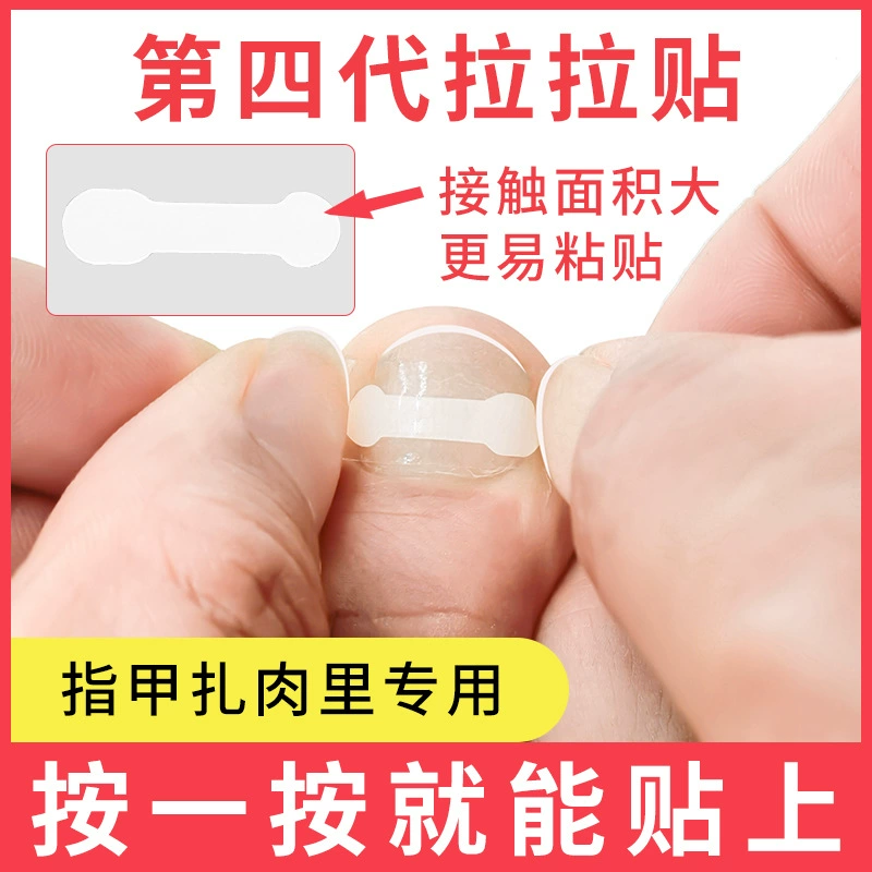 Устройство для коррекции вросших ногтей, пластырь для ногтей при воспалении, специальные ножницы для ногтей для домашнего использования, быстросохнущая лента для маникюра.