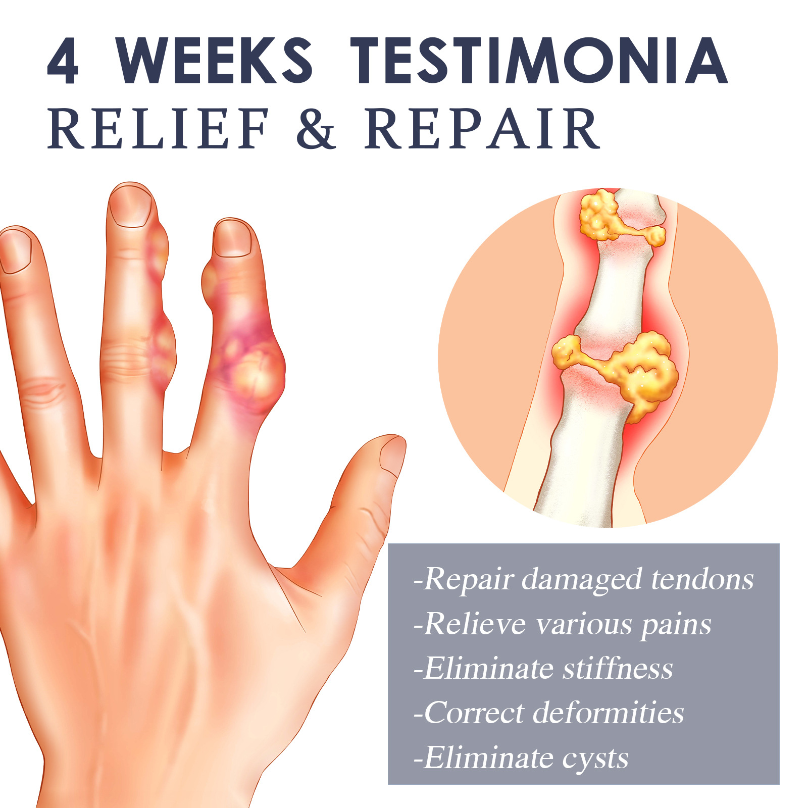 Bee Venom Joint Cream Image 5