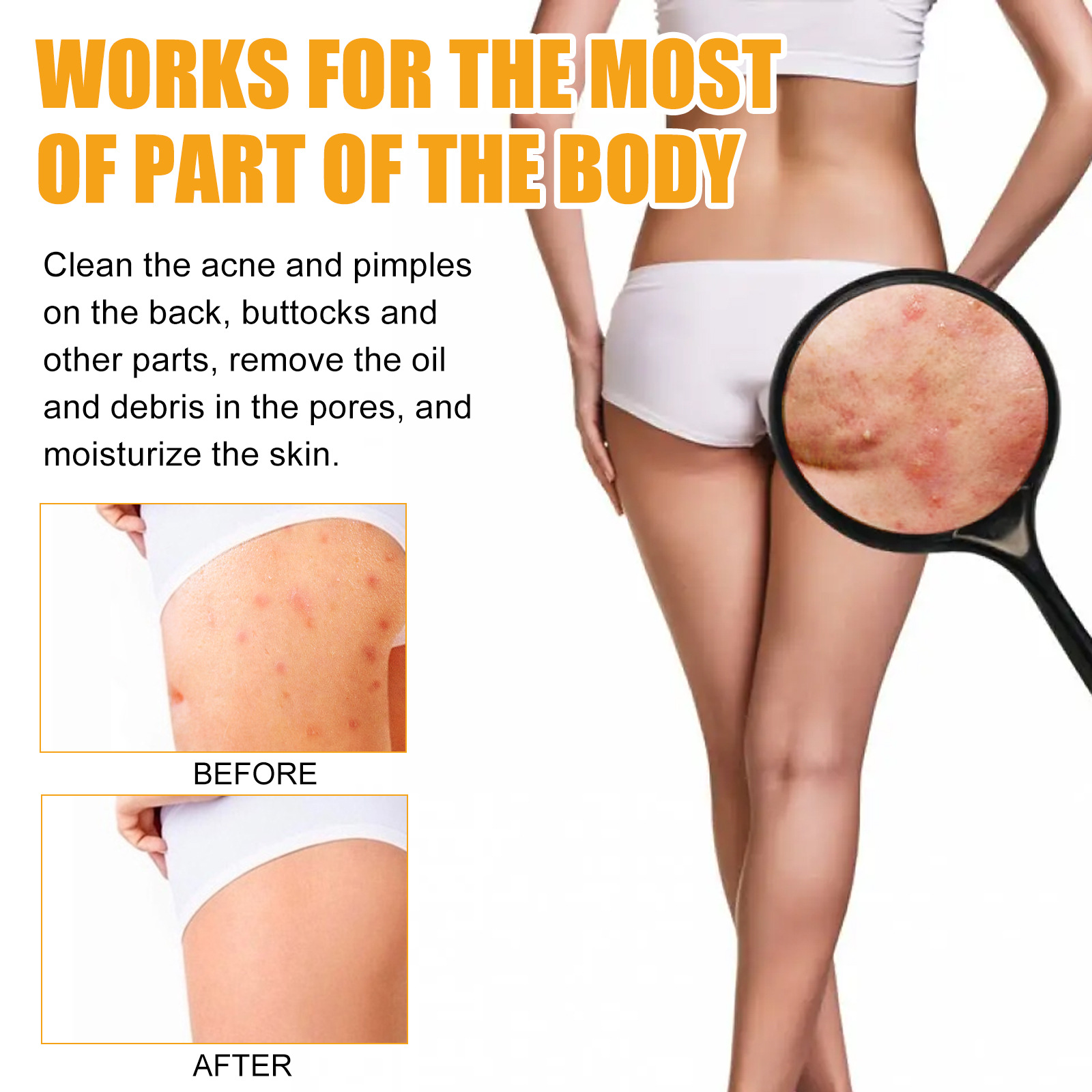 Jayusing Anti Cream Lighten and Acne Marks Esencja do nawilżania i naprawy skóry na ustach_voghion.com