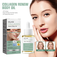 EELHOE �zԭ�������w���A�� ���o���w���w�ֱ۶�������pӯ�o����