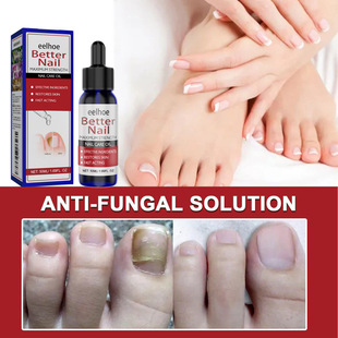 EELHOE Nail Repair Liquid Nail Care Hand and Foot Nail Repair Moisturizing and Cleansing Nail Repair Liquid for Onychomycosis