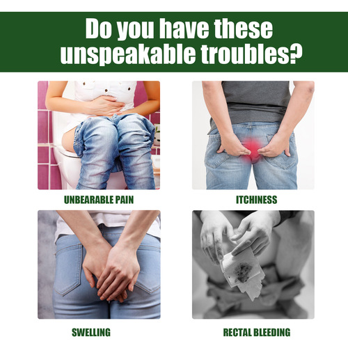 EELHOE Anal Relief Spray, Soothing and Swelling Hemorrhoid Spray, Hemorrhoid Cream, Eliminate Flesh Balls, Break Hemorrhoids, Body Care and Relieve Itching