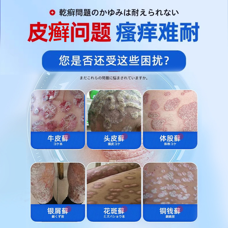 岩井弘牛皮水虫かゆみ止めクリーム正規品殺菌頑固性外用皮膚専用クリーム工場直営|undefined