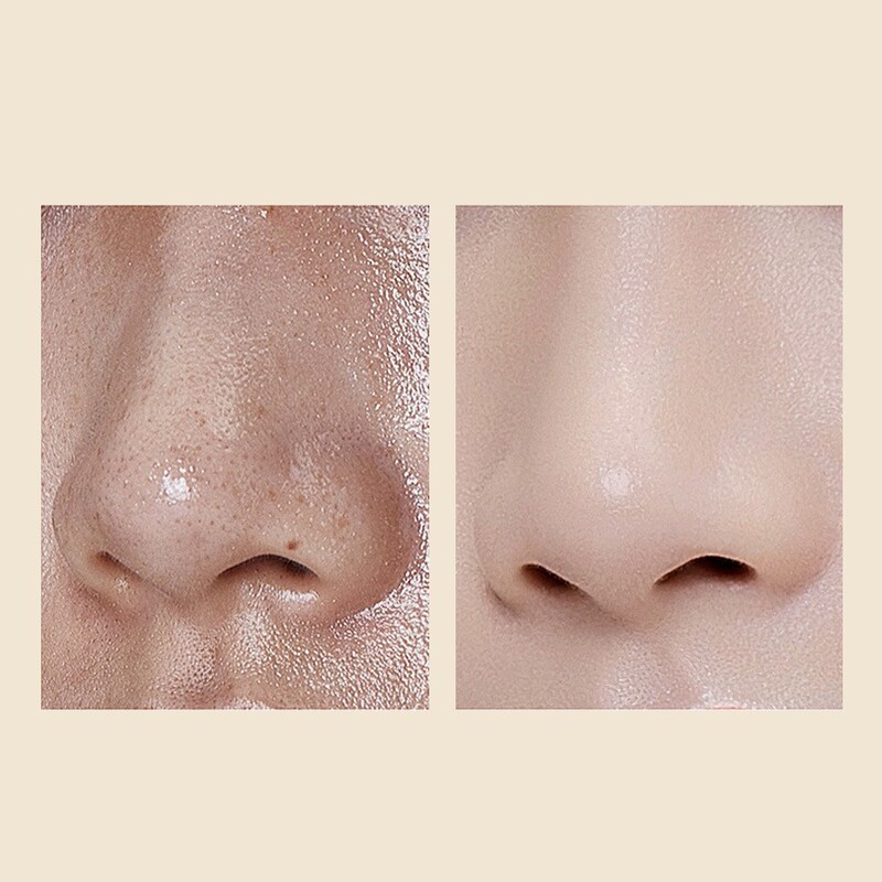跨境爆款Black rice ampoule Soft Exfoliating Face去角质去黑头|undefined