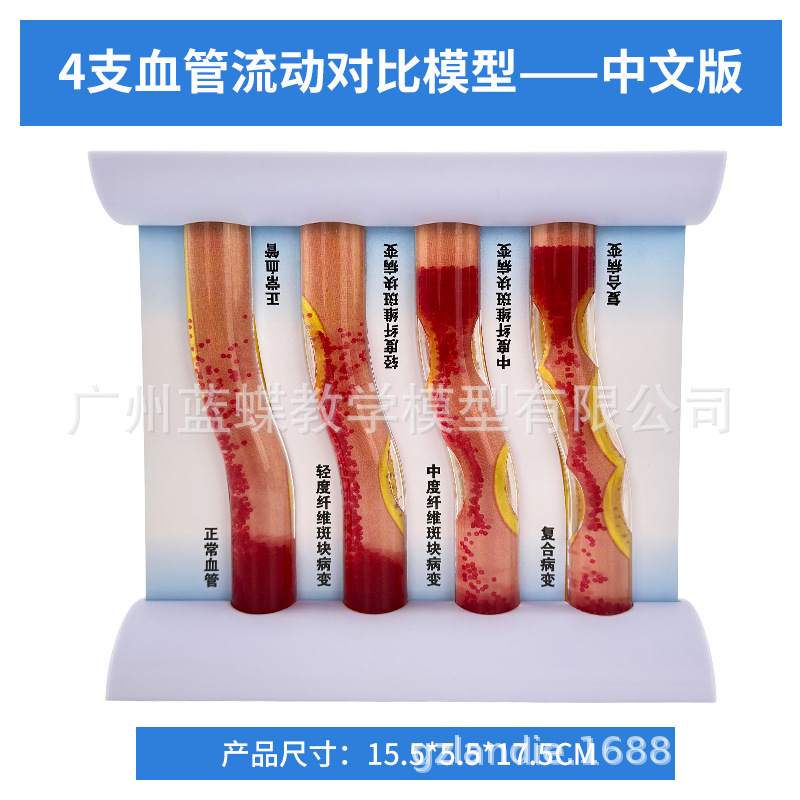 ���������״��������Ѫ�ܶ���ģ��Ӳ��ģ����������ģ��Ѫ˨ģ��