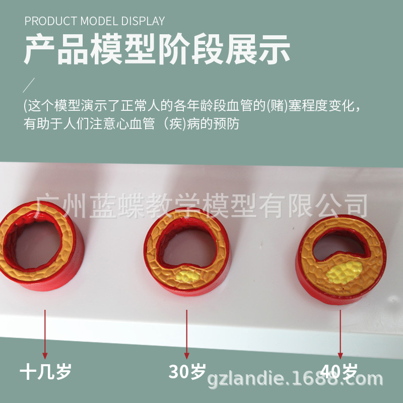 ����Ѫ�ܽ���ģ�� Ѫ��ģ�� ����/Ӳ��չʾ ���׶������Ѫ��չʾ