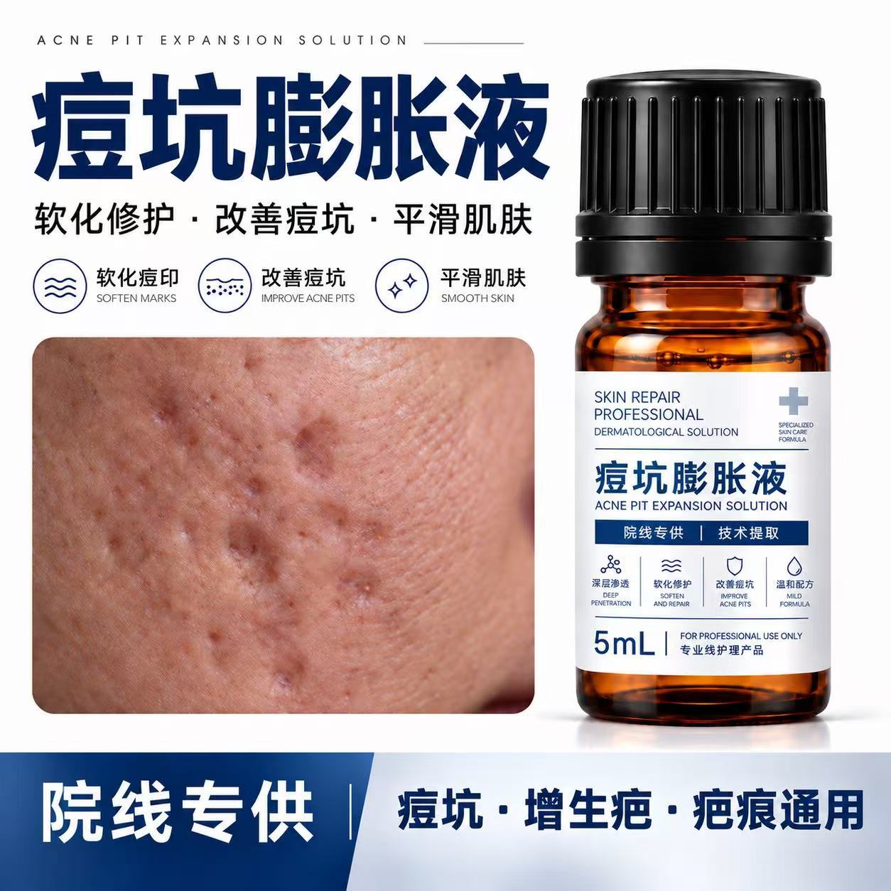 Acne scar filler, pore-minimizing serum, acne scar repair serum, beauty salon scar treatment, acne scar growth serum