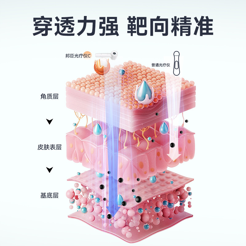 邦臣uv 308c1白なまず狭いスペクトルnbuvb家庭用医療用紫外線ランプ乾癬乾癬光治療器|undefined