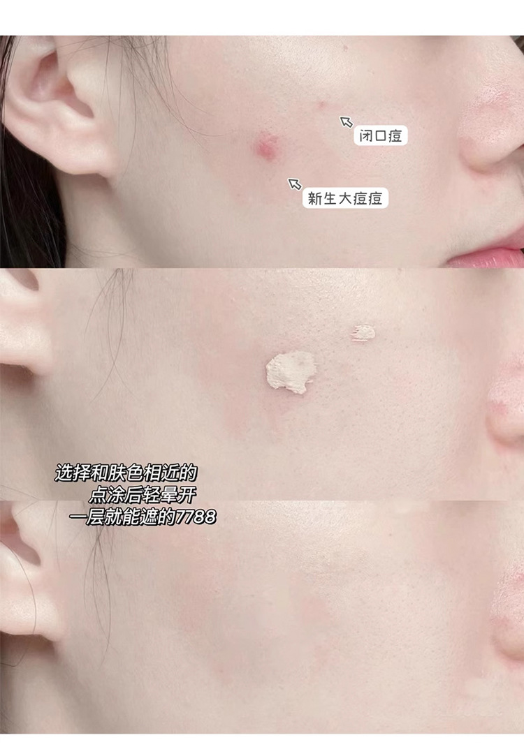 Concealer to cover acne marks, dark circles, freckles and nasolabial folds, moisturizing without clotting, matte, brightening and flattering nose, profile contouring liquid undefined