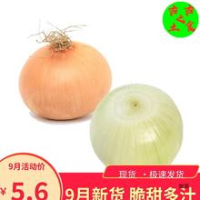 山东白洋葱黄洋葱水果洋葱甜新鲜包邮批10斤大网红洋葱生吃圆葱发