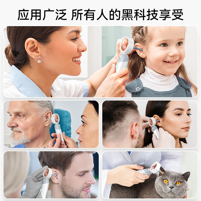 跨境爆款高清耳道检耳镜个人护理智能可视耳镜窥耳仪耳鼻喉检查镜|undefined