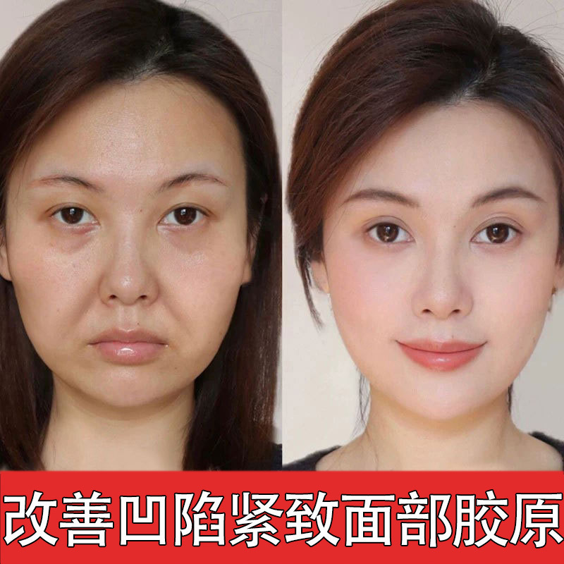 胶原蛋白重组霜紧致抗皱川字纹保湿补水正品专用面霜精华批发膏|undefined