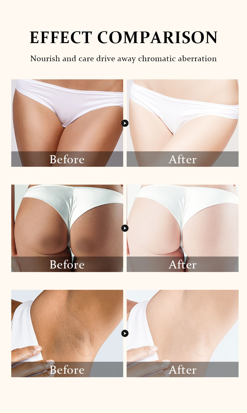 Black Removal Cream Private Cream Brightening Underarm Inner Thighs Black Removal Cream Whitening Cream_voghion.com