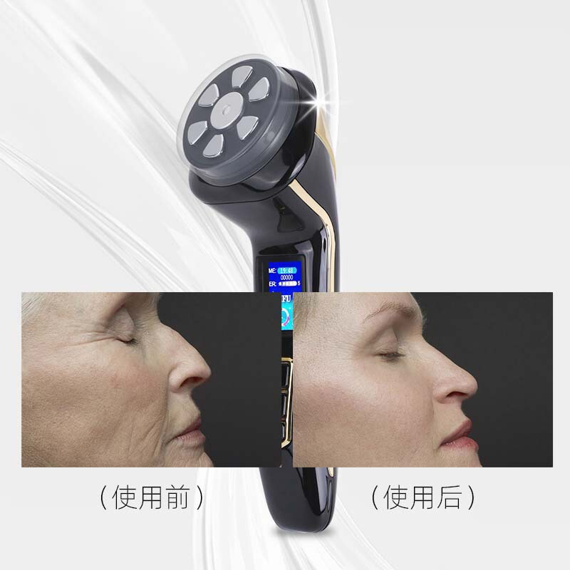 MINI三世代hifu四合一超音波ナイフ美容器家庭用顔マイクロ電流引き締めマッサージ器|undefined