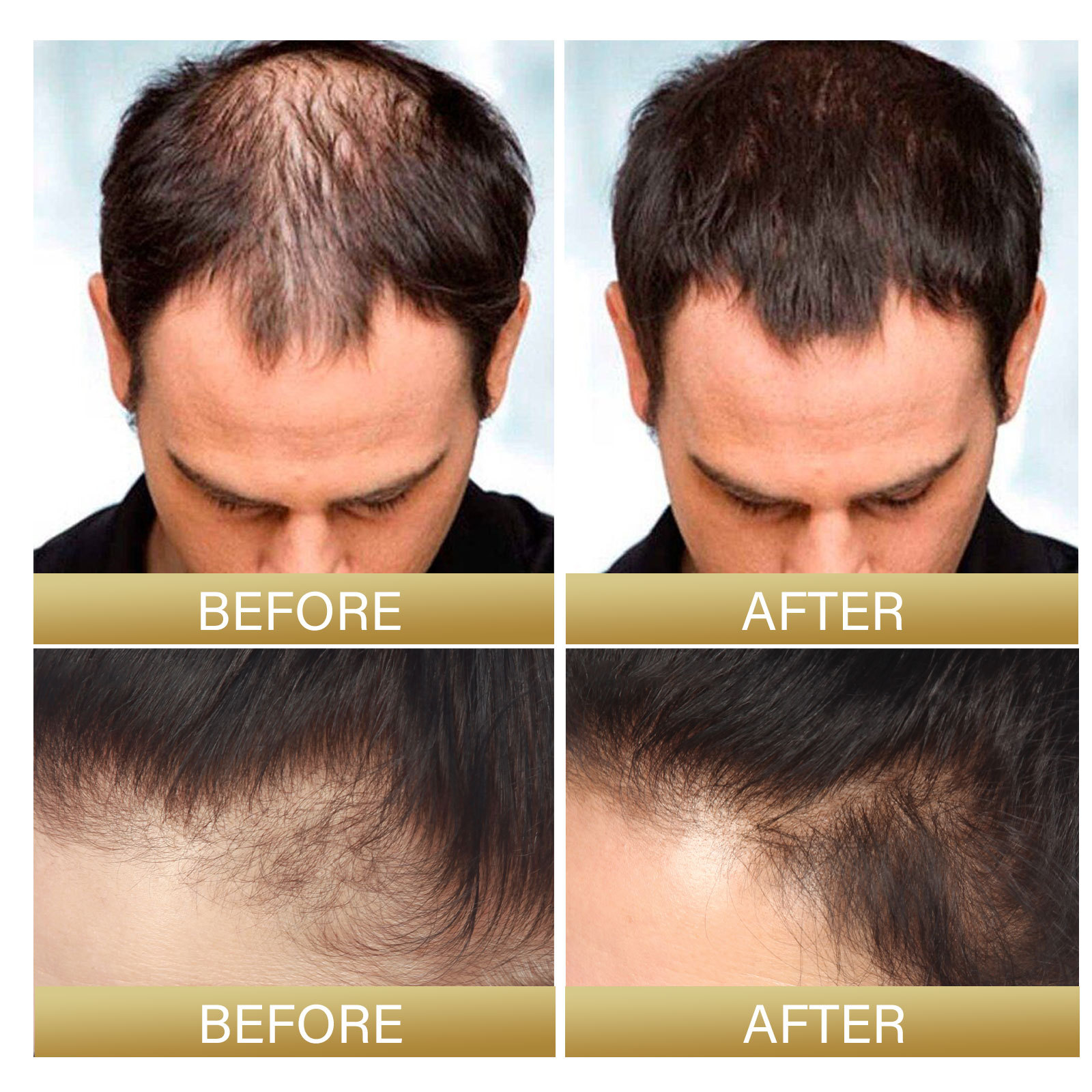 EELHOE spra de arroz negro, reparación fuerte, firme y densa que nutre la raíz del cabello, alisa el cabello y crece_voghion.com