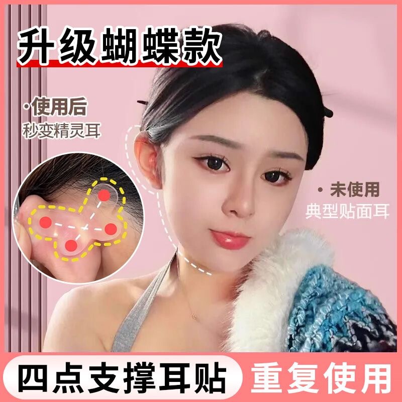 Butterfly-Shaped Elf Ear Stickers with Strong Invisible Support, Ear Shaping Stickers, Ear Correction Device for Protruding Ears Butterfly-Shaped Elf Ear Stickers with Strong Invisible Support, Ear Shaping Stickers, Ear Correction Device for Protruding Ears
