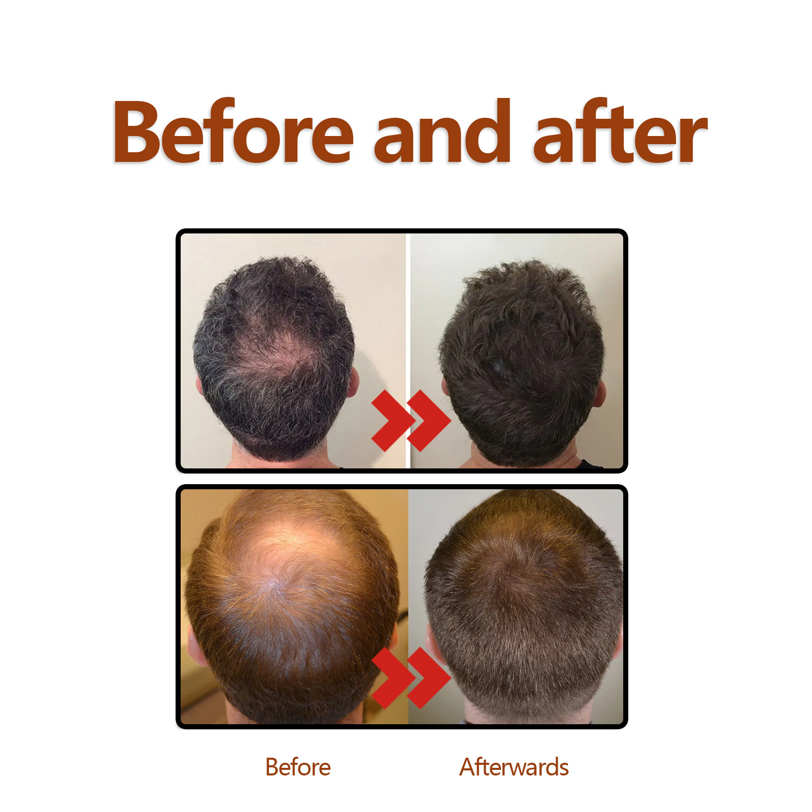 EELHOE zeliščni losjon za lase od korenin učvrsti in obnovi debelo lasno linijo, krepi lase, vlaži lase in preprečuje izpadanje las_voghion.com