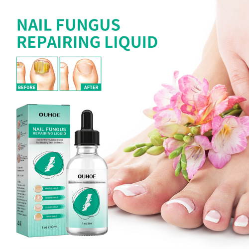 OUHOE Toenail Repair Solution Thickened Onychomycosis Onychomycosis Soft Nail Repair Solution on Hands and Feet Cleansing and Brightening Nail Repair Solution