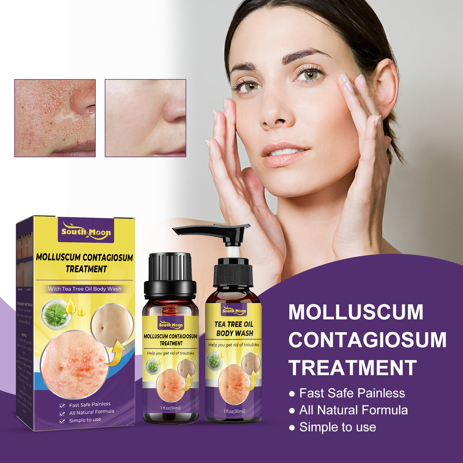 Skin Cleaning Removal of Underarm Hand and Foot Anti Wart Flat Care Liquid Set_voghion.com