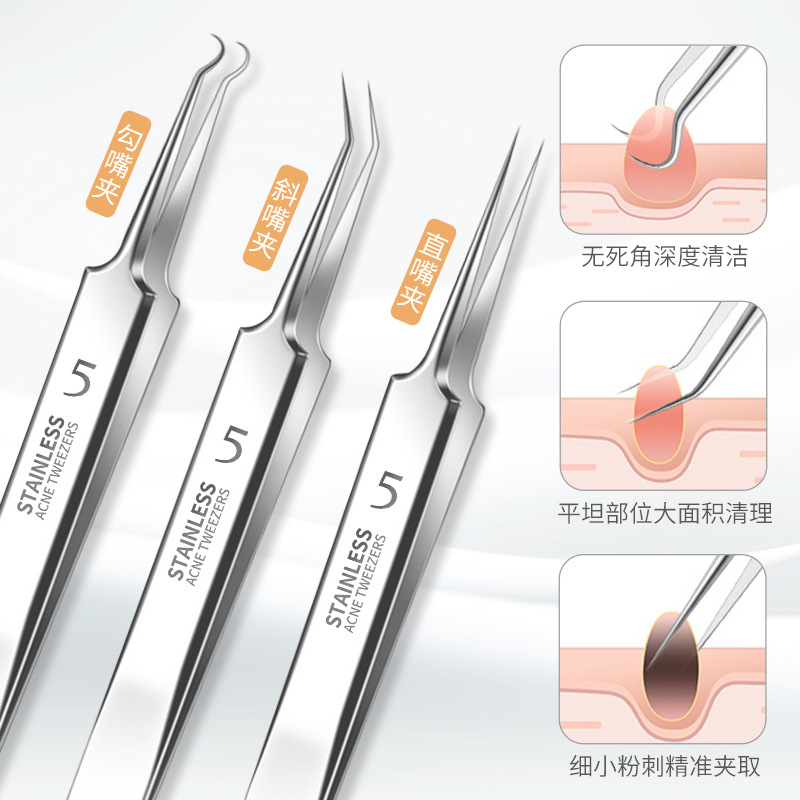 廠家不鏽鋼粉刺針套裝超尖細胞夾4件套粉刺夾痘痘針美容工具鏡子