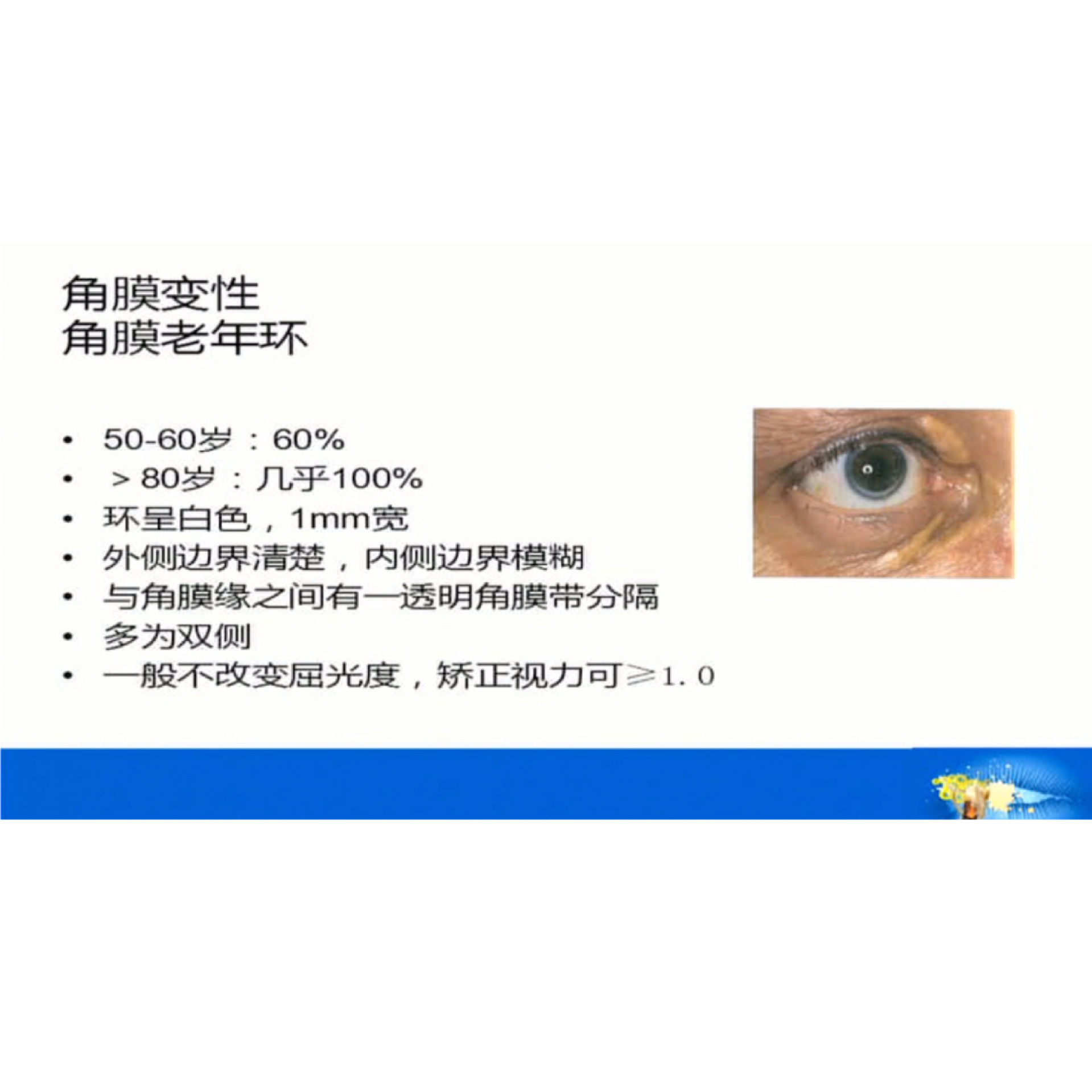 Ӱ�����ⲻ�������ĳ����۲� �γ�����