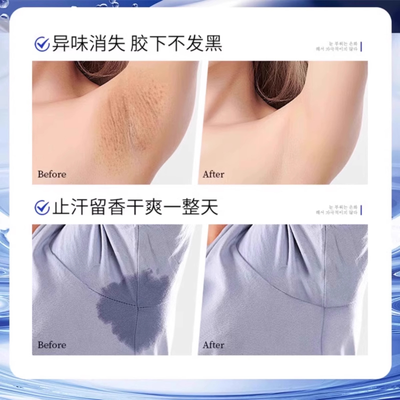 南京銅仁堂 アルミジルコン四塩化物 制汗剤 脇の下の消臭制汗スプレー 体臭除去剤 消臭水クリーム|undefined
