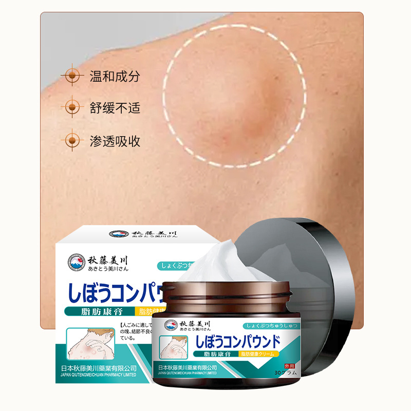 crema de salud para uso externo para aliviar grasa de grasa de grasa múltiple o grasa dura de grasa de grasa de grasa de grasa única